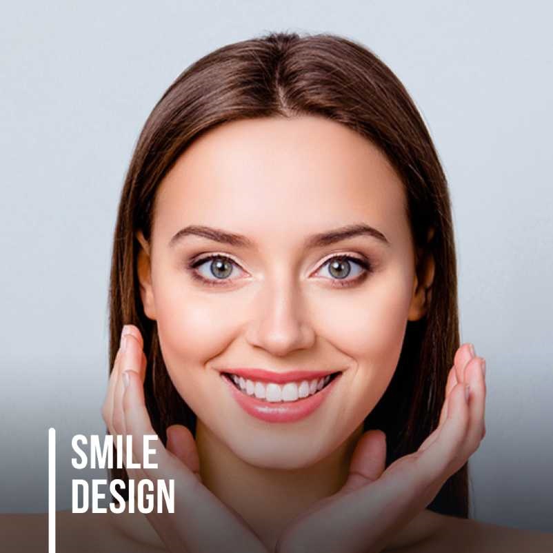 smile-design